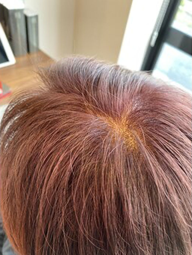 おしゃれ染めで白髪染め