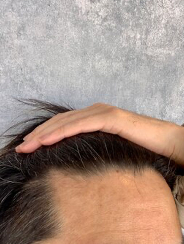 デミドウはじめる前