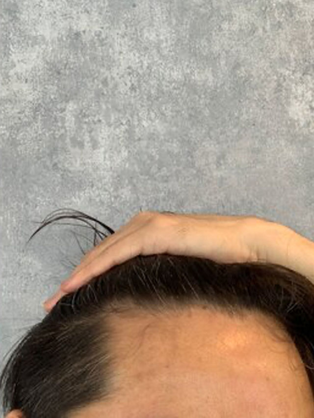 デミドゥの育毛剤